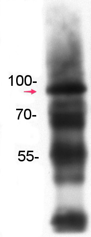 Western blot using anti-SUMO3 antibodies